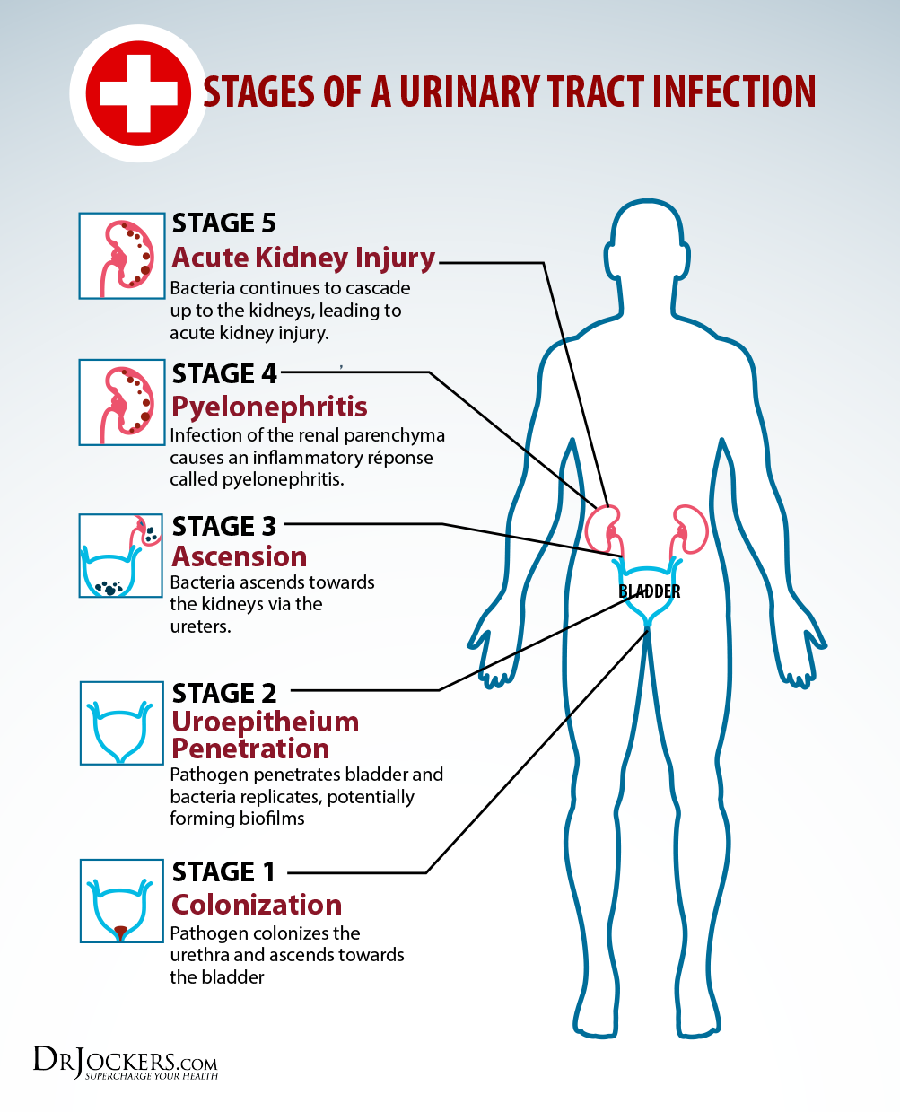 can-a-uti-cause-back-pain-drhouse