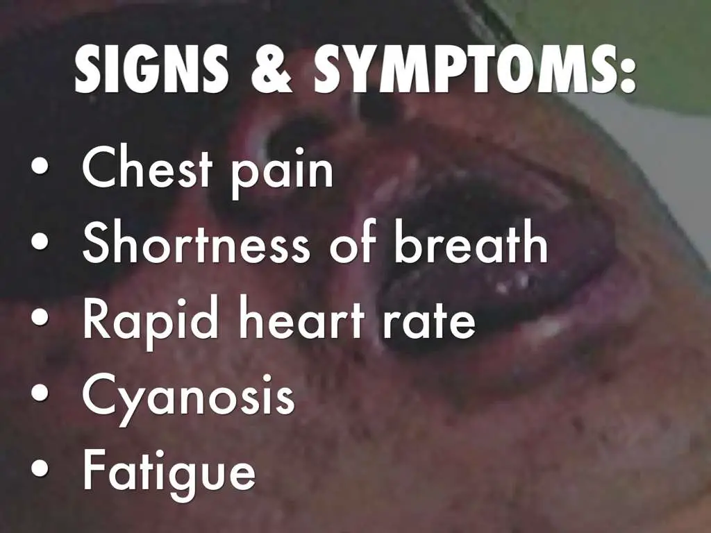 Dry Cough Chest Pain Shortness Of Breath