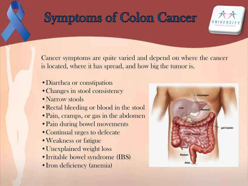 is-fatigue-a-sign-of-colon-cancer-fatiguetalk