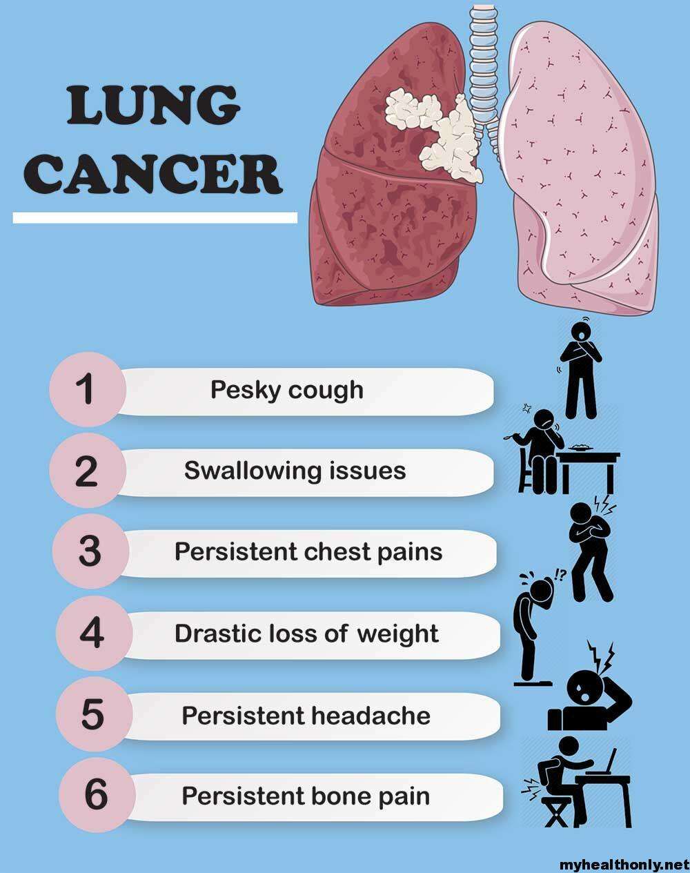 stage-4-lung-cancer-extreme-fatigue-fatiguetalk